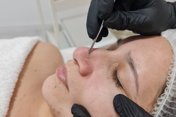 ADA SPA - photo 4